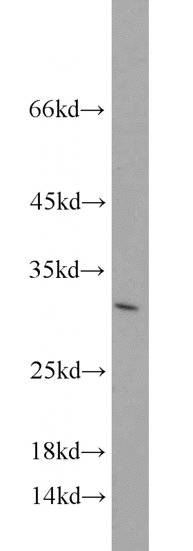 human brain tissue were subjected to SDS PAGE followed by western blot with Catalog No:110871(YEATS4 antibody) at dilution of 1:300