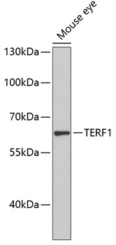 Western blot - TERF1 Polyclonal Antibody 