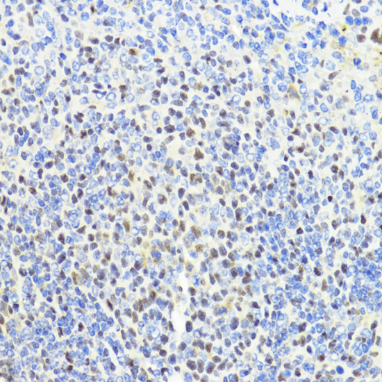 Immunohistochemistry - CTCF Polyclonal Antibody 
