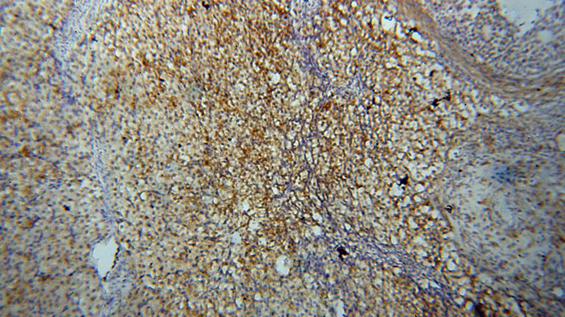Immunohistochemical of paraffin-embedded human ovary using Catalog No:114153(PPP1R15B;CReP antibody) at dilution of 1:100 (under 10x lens)