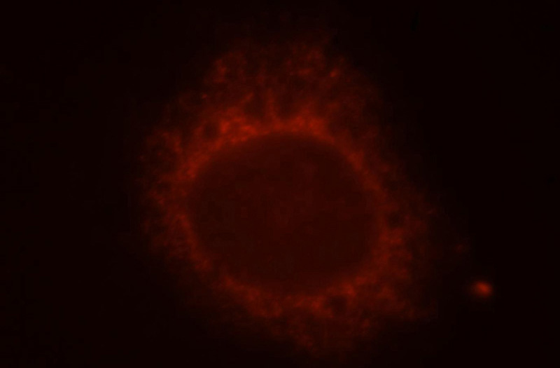 Immunofluorescent analysis of MCF-7 cells, using RCVRN antibody Catalog No:114675 at 1:25 dilution and Rhodamine-labeled goat anti-rabbit IgG (red).