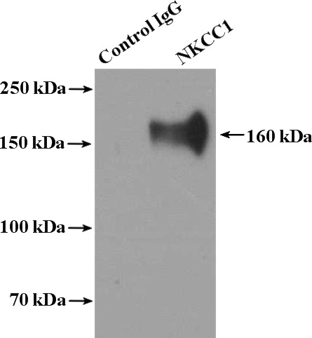 IP Result of anti-SLC12A2 (IP:Catalog No:113194, 4ug; Detection:Catalog No:113194 1:500) with mouse brain tissue lysate 3600ug.