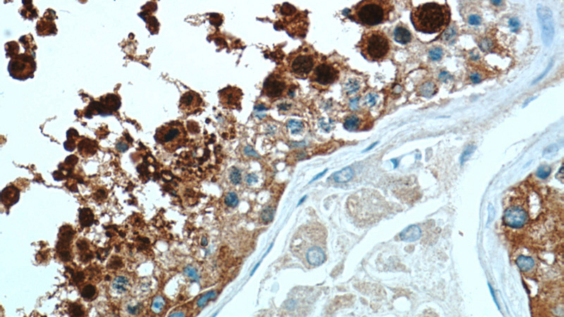 Immunohistochemical of paraffin-embedded human testis using Catalog No:111574(HSPA2 antibody) at dilution of 1:50 (under 40x lens)