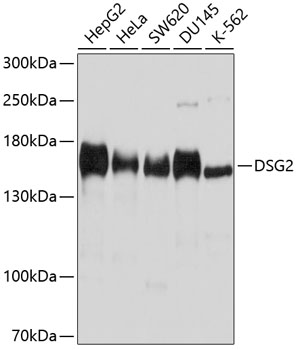 Western blot - DSG2 Polyclonal Antibody 