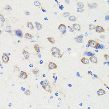 Immunohistochemistry - DLG1 Polyclonal Antibody 