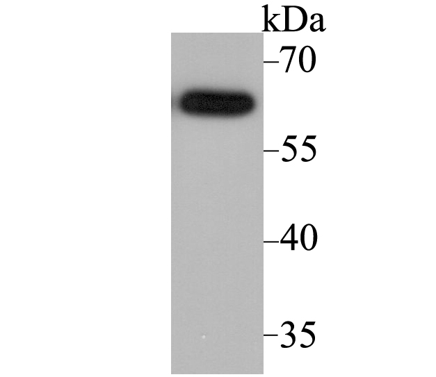 Fig1: Western blot analysis of ACCN2 on SH-SY-5Y cell lysate using anti-ACCN2 antibody at 1/2,000 dilution.