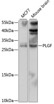 Western blot - PLGF Polyclonal Antibody 