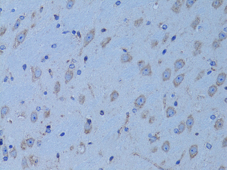 Immunohistochemistry - HADH Polyclonal Antibody 