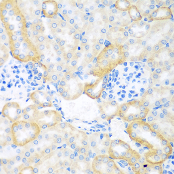 Immunohistochemistry - CEACAM7 Polyclonal Antibody 