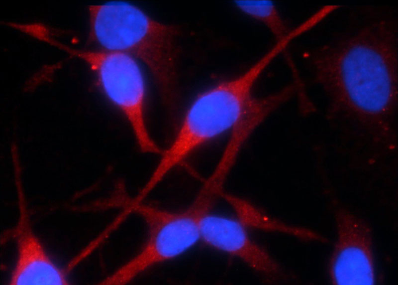 Immunofluorescent analysis of C6 cells using Catalog No:107367(KMO Antibody) at dilution of 1:25 and Rhodamine-Goat anti-Mouse IgG
