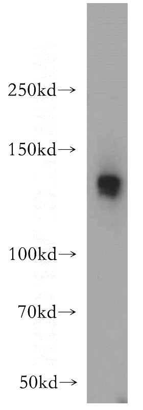 mouse heart tissue were subjected to SDS PAGE followed by western blot with Catalog No:115660(SR140 antibody) at dilution of 1:500