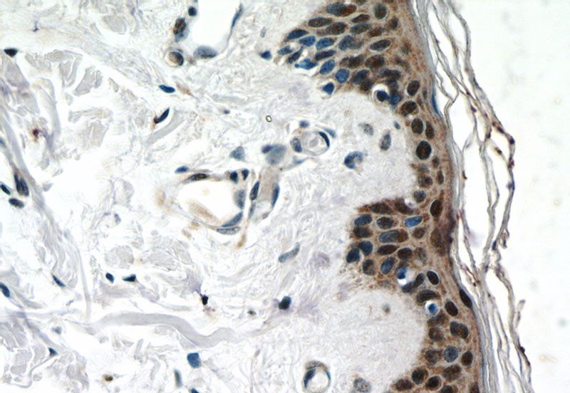 Immunohistochemistry of paraffin-embedded human skin slide using Catalog No:108948(CBX6 Antibody) at dilution of 1:50