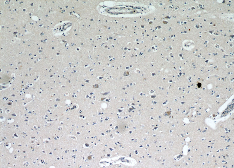 Immunohistochemical of paraffin-embedded human brain using Catalog No:112016(KIF5A antibody) at dilution of 1:100 (under 10x lens)