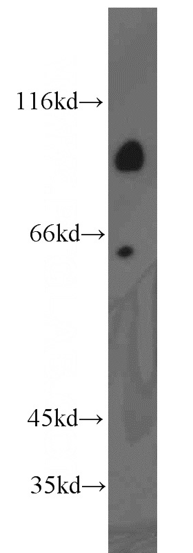 human heart tissue were subjected to SDS PAGE followed by western blot with Catalog No:108260(ARHGAP10 antibody) at dilution of 1:800