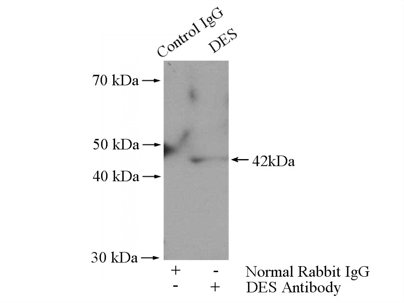 IP Result of anti-HP (IP:Catalog No:111339, 4ug; Detection:Catalog No:111339 1:500) with HepG2 cells lysate 2000ug.