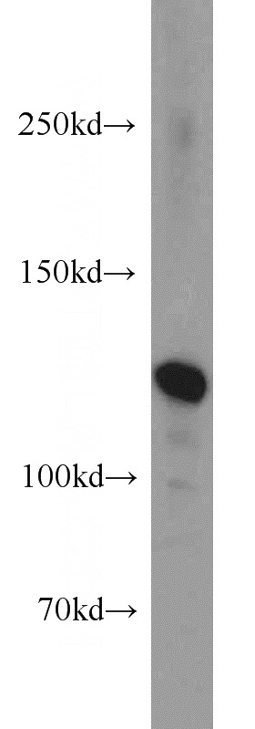 human brain tissue were subjected to SDS PAGE followed by western blot with Catalog No:113028(NCAM2 antibody) at dilution of 1:1000