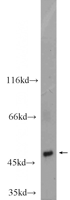 MCF7 cells were subjected to SDS PAGE followed by western blot with Catalog No:113395(NT5DC1 antibody) at dilution of 1:1000