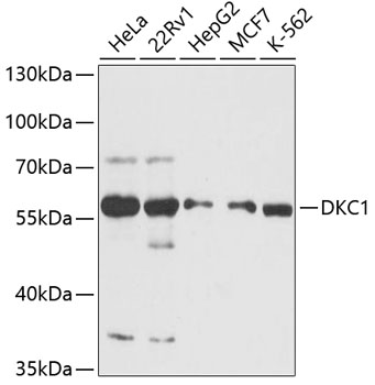 Western blot - DKC1 Polyclonal Antibody 