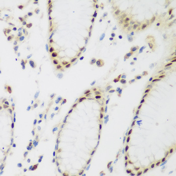 Immunohistochemistry - PPAN Polyclonal Antibody 