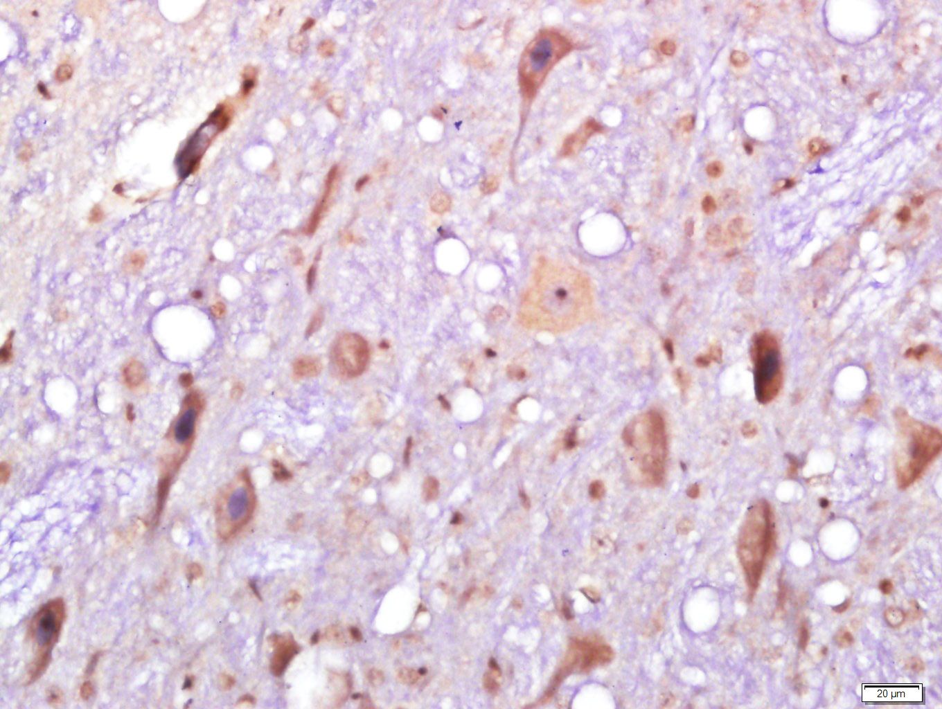Fig3: Paraformaldehyde-fixed, paraffin embedded (rat brain); Antigen retrieval by boiling in sodium citrate buffer (pH6.0) for 15min; Block endogenous peroxidase by 3% hydrogen peroxide for 20 minutes; Blocking buffer (normal goat serum) at 37℃ for 30min; Antibody incubation with (SLC38A2) Polyclonal Antibody, Unconjugated at 1:400 overnight at 4℃, followed by a conjugated secondary (sp-0023) for 20 minutes and DAB staining.