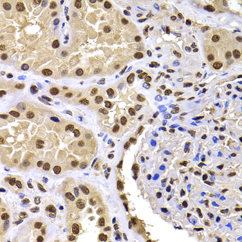 Immunohistochemistry - HIRIP3 Polyclonal Antibody 