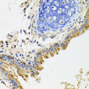 Immunohistochemistry - GP2 Polyclonal Antibody 