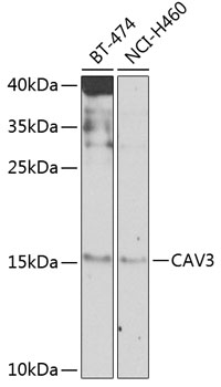 Western blot - CAV3 Polyclonal Antibody 