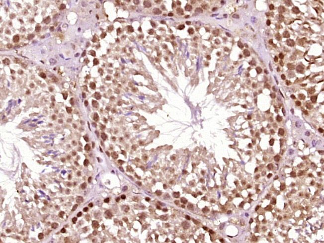 Fig1: Paraformaldehyde-fixed, paraffin embedded (mouse testis tissue); Antigen retrieval by boiling in sodium citrate buffer (pH6.0) for 15min; Block endogenous peroxidase by 3% hydrogen peroxide for 20 minutes; Blocking buffer (normal goat serum) at 37℃ for 30min; Antibody incubation with (Acrosin) Polyclonal Antibody, Unconjugated at 1:400 overnight at 4℃, followed by operating according to SP Kit(Rabbit) (sp-0023) instructionsand DAB staining