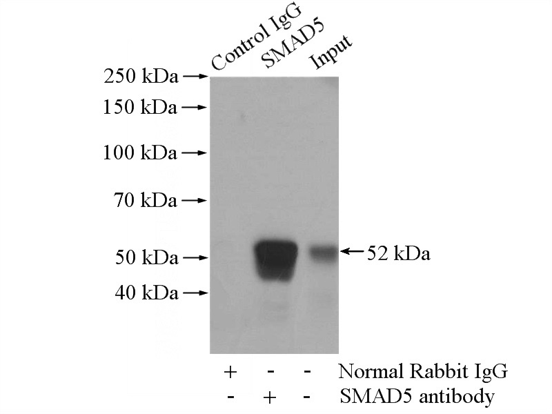 IP Result of anti-SMAD5 (IP:Catalog No:115421, 4ug; Detection:Catalog No:115421 1:1000) with K-562 cells lysate 3200ug.