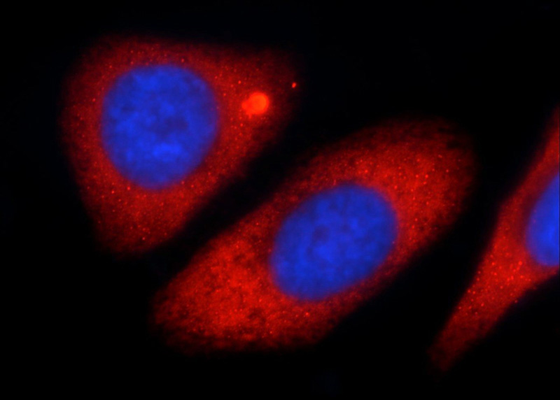 Immunofluorescent analysis of HepG2 cells using Catalog No:112103(KLHL31 Antibody) at dilution of 1:50 and Rhodamine-Goat anti-Rabbit IgG