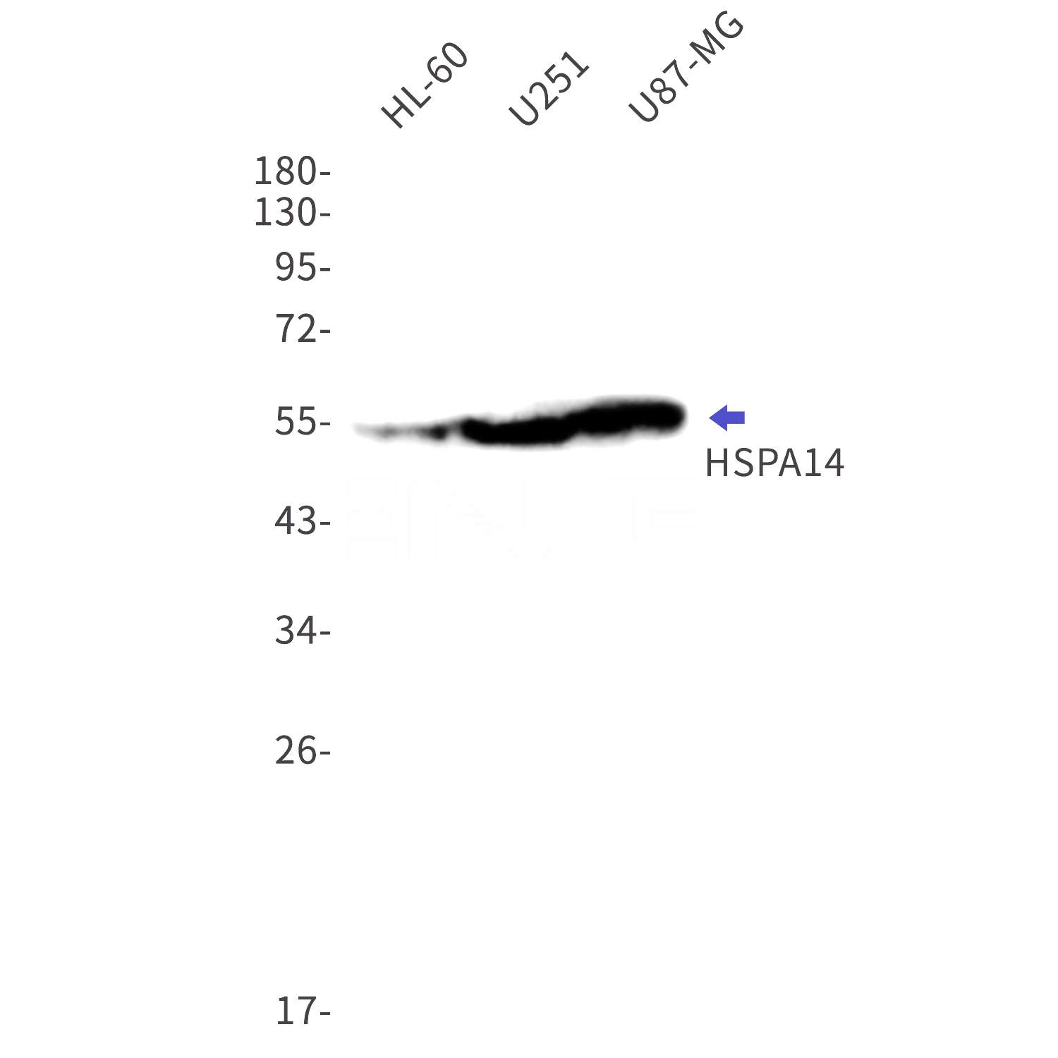 Western blot detection of HSPA14 in HL-60,U251,U87-MG cell lysates using HSPA14 Rabbit mAb(1:1000 diluted).Predicted band size:55kDa.Observed band size:55kDa.