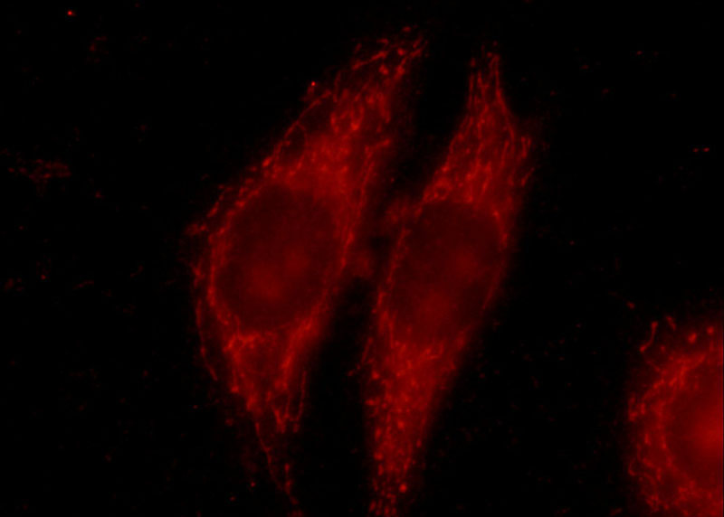 Immunofluorescent analysis of MCF-7 cells using Catalog No:111848(INSIG1 Antibody) at dilution of 1:50 and Rhodamine-Goat anti-Rabbit IgG