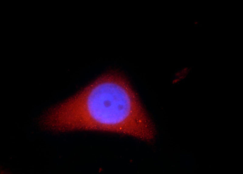 Immunofluorescent analysis of HepG2 cells, using ADH7 antibody Catalog No:107790 at 1:50 dilution and Rhodamine-labeled goat anti-rabbit IgG (red). Blue pseudocolor = DAPI (fluorescent DNA dye).