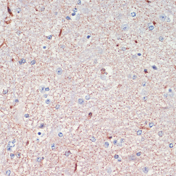 Immunohistochemistry - LRRK2 Polyclonal Antibody 