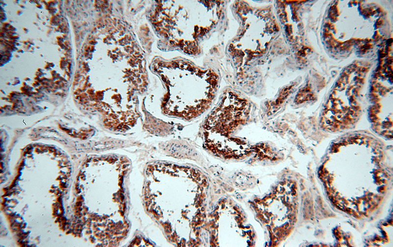 Immunohistochemical of paraffin-embedded human testis using Catalog No:111380(HDAC6 antibody) at dilution of 1:50 (under 10x lens)