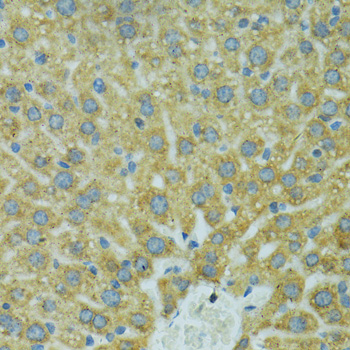 Immunohistochemistry - CYP2B6 Polyclonal Antibody 