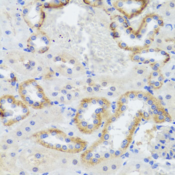 Immunohistochemistry - SYNPO Polyclonal Antibody 