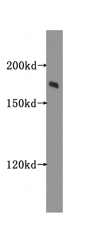 HeLa cells were subjected to SDS PAGE followed by western blot with Catalog No:116768(VPRBP antibody) at dilution of 1:500