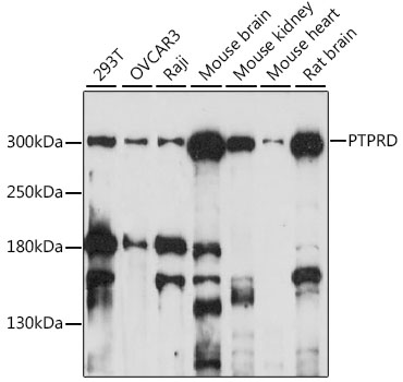 Western blot - PTPRD Polyclonal Antibody 
