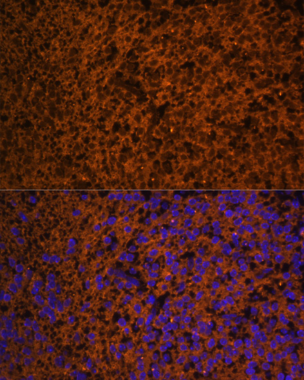 Immunofluorescence - PTCH1 Polyclonal Antibody 