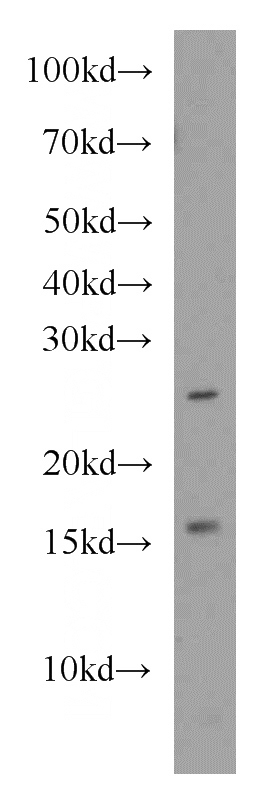 Jurkat cells were subjected to SDS PAGE followed by western blot with Catalog No:113636(PDRG1 antibody) at dilution of 1:1000
