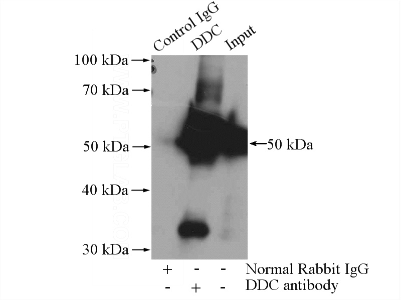 IP Result of anti-DDC (IP:Catalog No:110059, 4ug; Detection:Catalog No:110059 1:800) with mouse brain tissue lysate 4000ug.