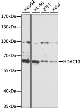 Western blot - HDAC10 Polyclonal Antibody 