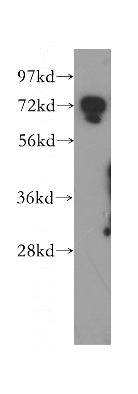 human brain tissue were subjected to SDS PAGE followed by western blot with Catalog No:110136(DYNC1I2 antibody) at dilution of 1:500