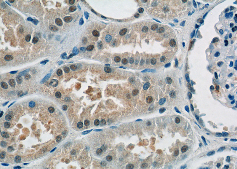 Immunohistochemistry of paraffin-embedded human kidney tissue slide using Catalog No:114676(RECQL4 Antibody) at dilution of 1:50 (under 40x lens)