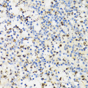Immunohistochemistry - SUMO4 Polyclonal Antibody 