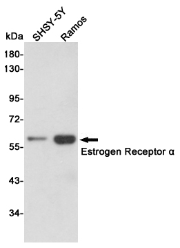 Western blot analysis of extracts from SHSY-5Y and Ramos cell lysates using Estrogen Receptor α mouse mAb (1:500 diluted). Predicted band size:66KDa. Observed band size:66KDa.