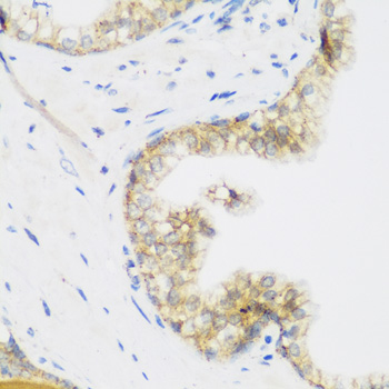 Immunohistochemistry - KIAA1456 Polyclonal Antibody 