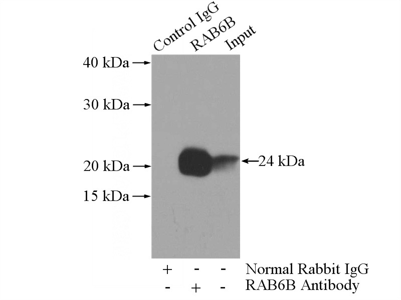 IP Result of anti-RAB6B (IP:Catalog No:114457, 3ug; Detection:Catalog No:114457 1:1000) with mouse brain tissue lysate 4000ug.