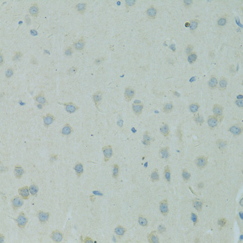 Immunohistochemistry - SMAD6 Polyclonal Antibody 